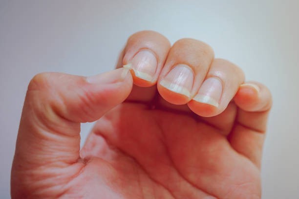 Fingernails grow faster than toenails.