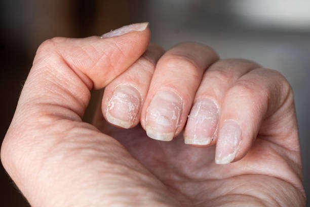 Nail color says a lot.