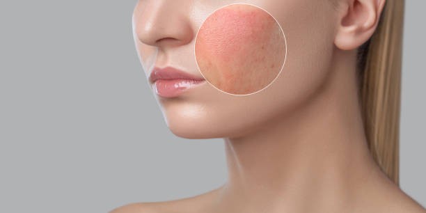 Some products may irritate sensitive skin.