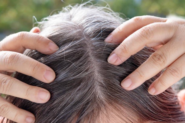 Gray hair isn’t just about age
